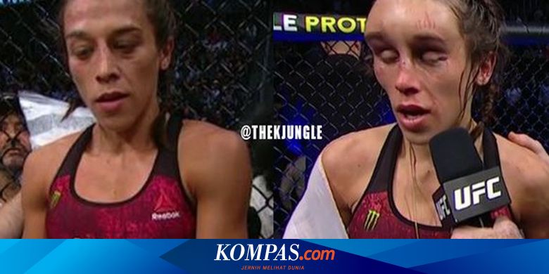 Joanna Jedrzejczyk Buka Suara Soal Cedera Kepala Horor Lawan Zhang Weili Halaman All Kompas Com