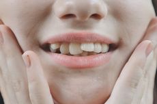 13 Penyebab Gigi Bengkok dan Cara Mengatasinya