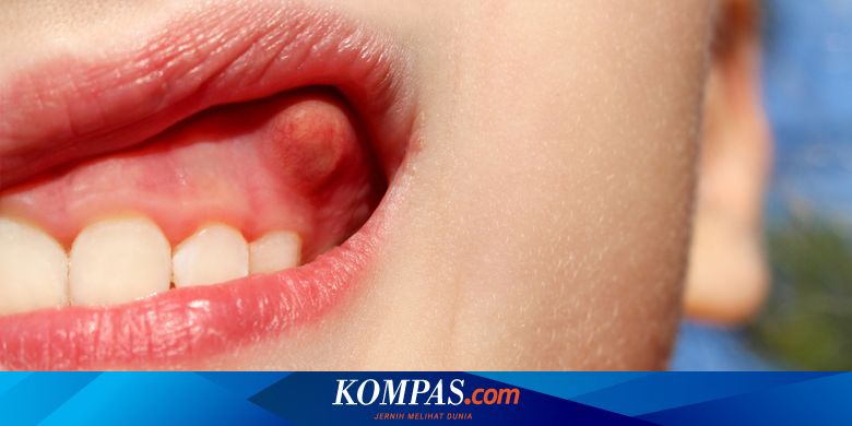kenapa gigi sakit dan gusi bengkak 12