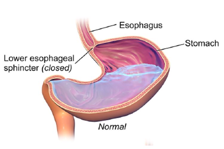 Ilustrasi asam lambung