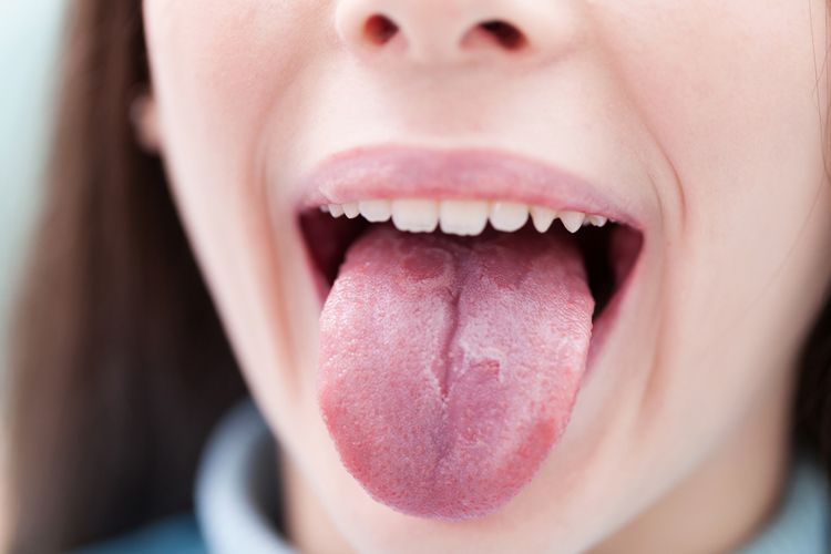 Membersihkan lidah bisa meningkatkan kualitas indera pengecap.