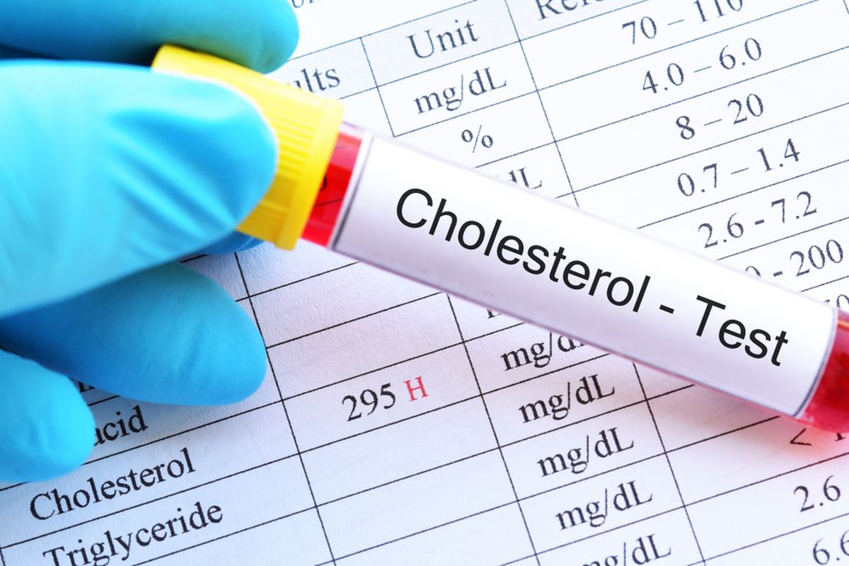 Efektivitas statin untuk menurunkan kolesterol sudah terbukti karena bisa menurunkan risiko hingga 35 persen.