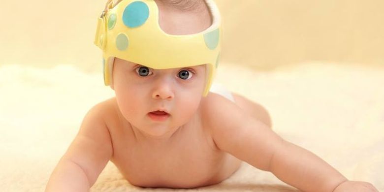 Kapan Bayi Dengan Kepala Peyang Memerlukan Helm Khusus Halaman All Kompas Com