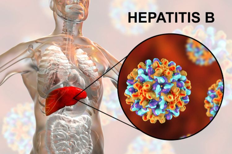 Ilustrasi hepatitis B, gejala hepatitis B. 