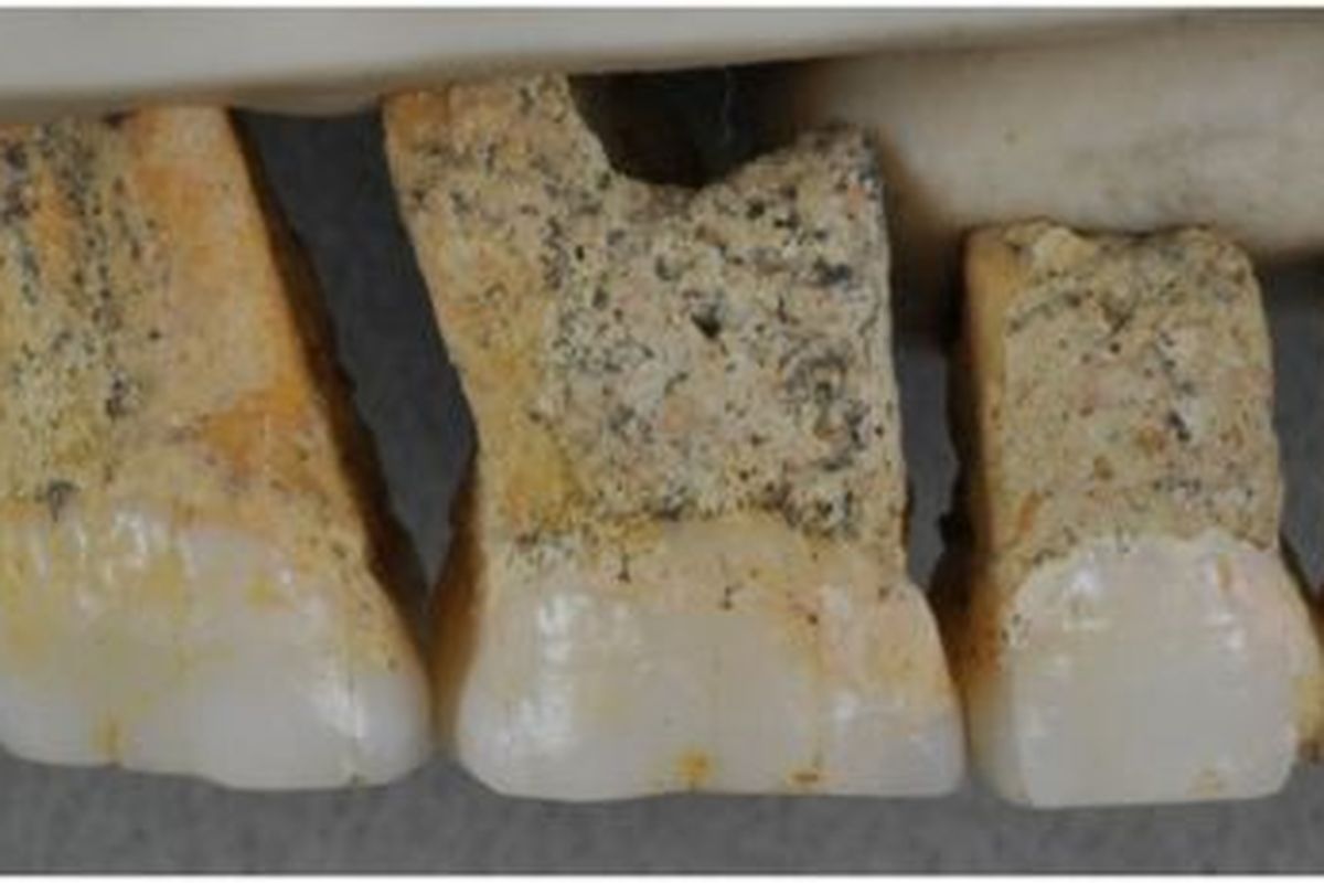 Gigi Homo luzonensis konsisten dengan sisa-sisa jasad yang dikaitkan dengan spesies baru tersebut. 