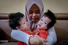Bayi Kembar Siam di Bandung Barat Butuh Bantuan untuk Operasi Pisah Tubuh