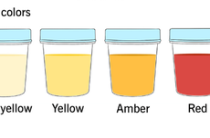 Daftar Penyakit yang Bisa Menyebabkan Ada Darah dalam Urine, Apa Saja?