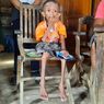 Idap Penyakit Komplikasi, Bocah 9 Tahun di Blora Tak Bisa Jalan, Begini Kondisinya