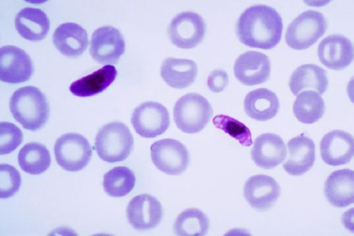 Kenampakan Plasmodium falciparum, parasit malaria, dalam pengamatan mikroskop. 