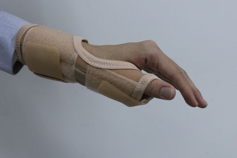 De Quervain's Tenosynovitis