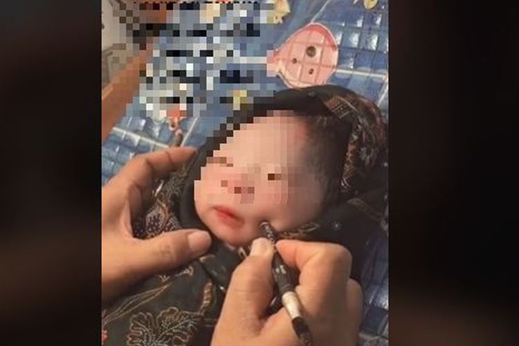 Pipi bayi ditusuk diduga untuk membentuk lesung pipi