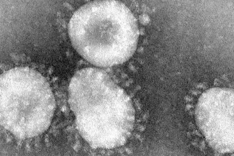 Virus korona saat dilihat dengan menggunakan mikroskop.