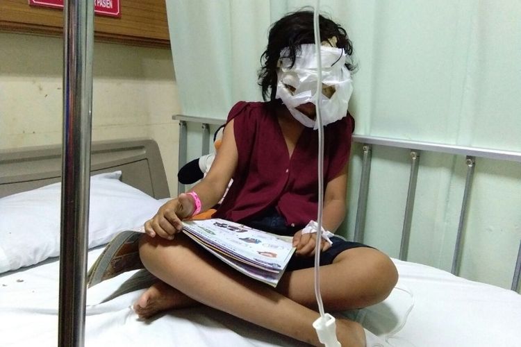 Dengan wajah dibalut perban, Rachel Heriani (11) asyik membaca buku saat ditemui di RSHS Bandung, Senin (9/10/2017) sore. 
