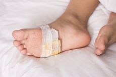 5 Cara Mengobati Luka di Kaki Penderita Diabetes