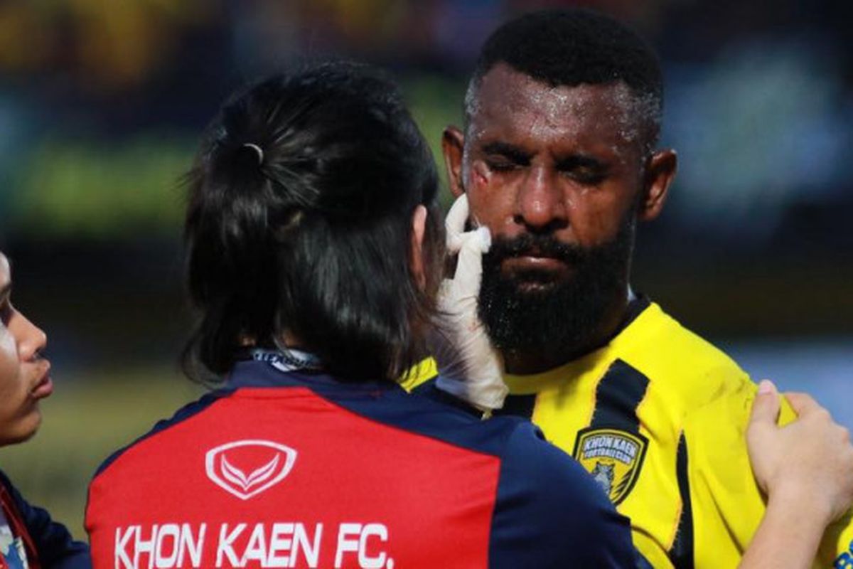 Bek Khon Kaen FC, Rudolof Yanto Basna (kanan) mendapatkan pertolongan dari tim medis timnya saat menjamu Kasetsart FC pada laga pekan ke-22 Liga Thailand 2 2018, 29 Juli 2018.