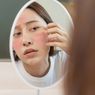 Penyebab Alergi Terhadap Produk Skincare dan Cara Mengatasinya