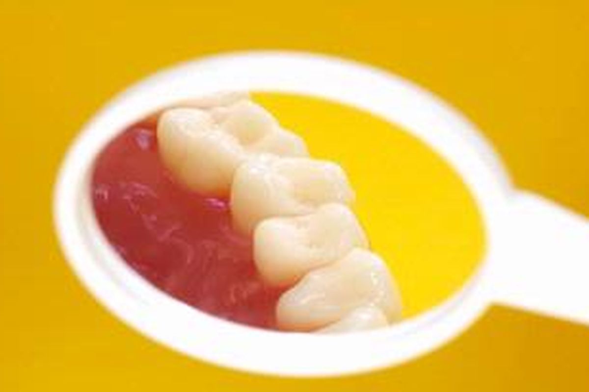 Ilustrasi gigi dan gusi