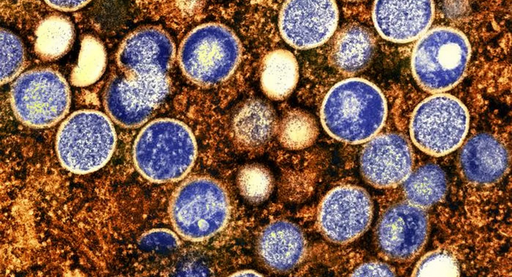 Muncul Virus Misterius Alaskapox, Apa Itu?