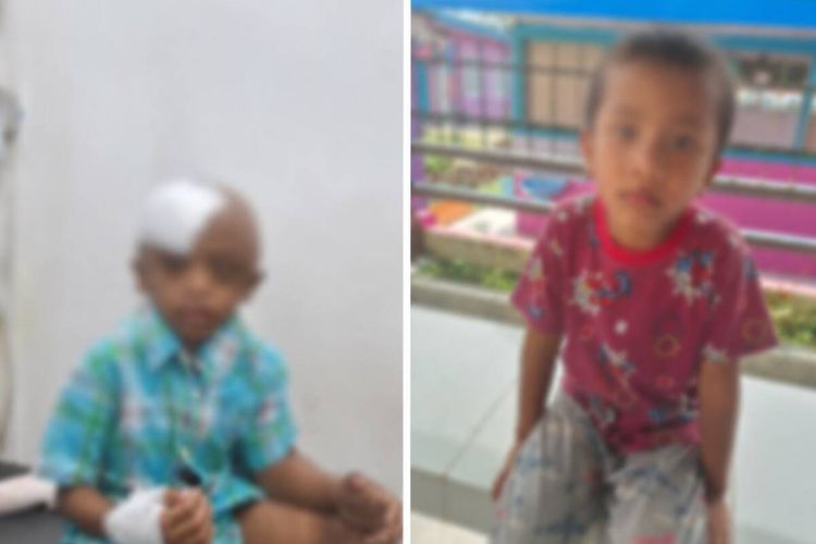 2 Bocah di Sidikalang Diduga Disiksa Bibinya Sendiri, Polisi Dalami Motif