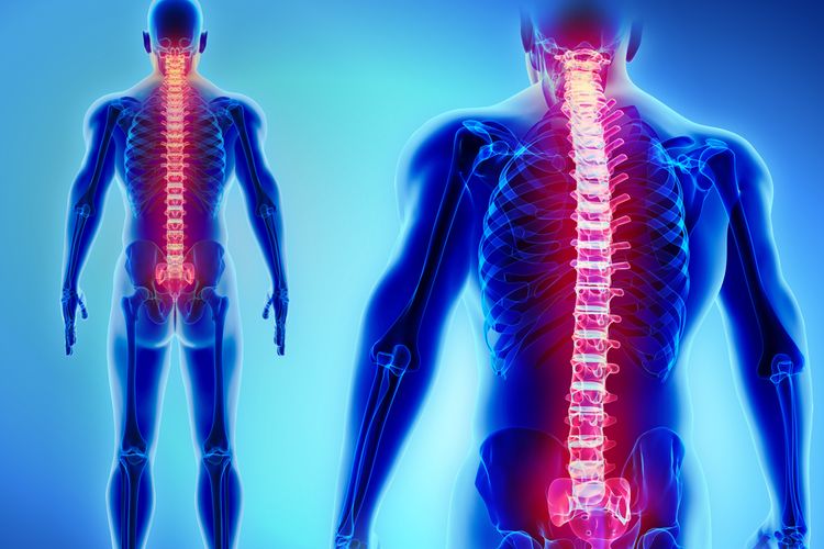 Ilustrasi tulang belakang. Kanker tulang belakang dapat menyebabkan Anda mengalami nyeri punggung terus-menerus, kesulitan berdiri, hingga kelumpuhan di beberapa bagian tubuh.