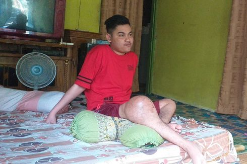 Marwan 3 Tahun Idap Tumor Ganas di Lutut, Ibu: Kami Pasrah bila Harus Amputasi
