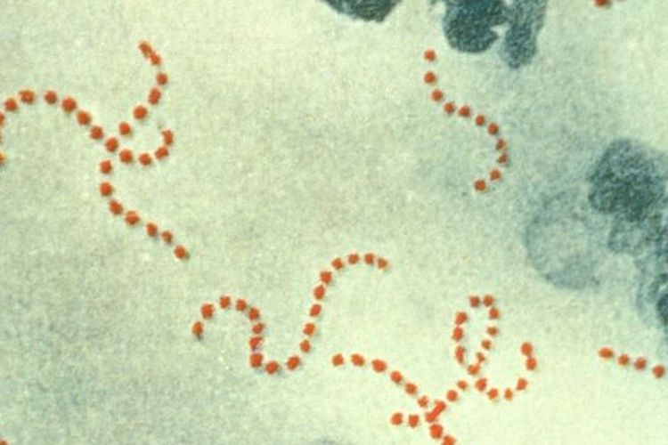 Ilustrasi bakteri Streptococcus pyogenes. Di Jepang terjadi lonjakan kasus infeksi bakteri Streptokokus Grup A, khususnya varian Streptococcus pyogenes, yang mengakibatkan radang tenggorokan hingga komplikasi penyakit pemakan daging. 