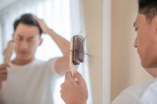 3 Penyebab Utama Garis Rambut Mundur dan Cara Mengatasinya
