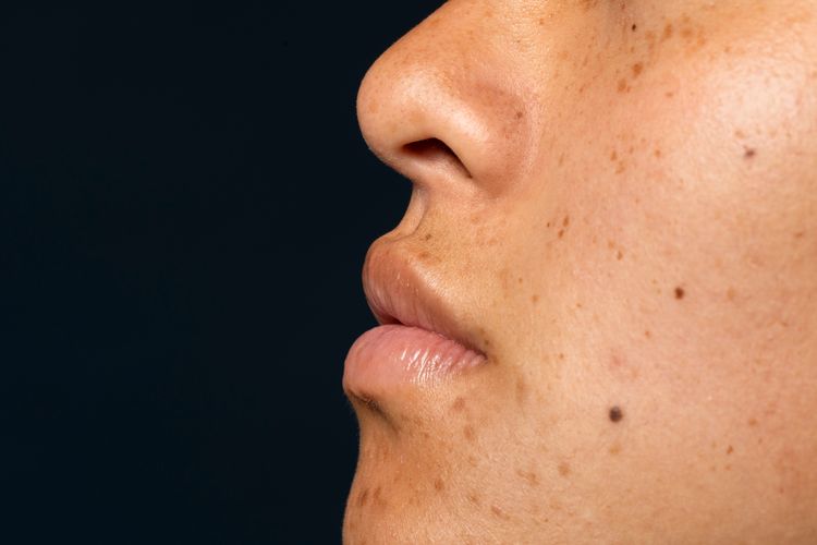 Bagaimana cara pakai sunscreen yang benar? Menurut dokter, susncreen harus dioles ulang setiap tiga jam agar kulit tetap terlindungi.