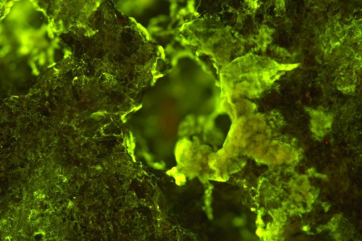 Gambar Sphingomonas desiccabilis, bakteri yang dapat mengekstrak elemen mineral di luar angkasa.

