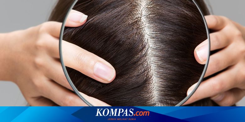 Penyakit Kulit Kepala Perih - Gejala, Penyebab, Pengobatan - Kompas.com