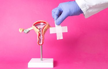 10 Penyebab Histerektomi yang Membuat Wanita Tanpa Rahim Halaman ...
