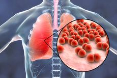 Mengenal Bakteri Streptococcus Pneumoniae, Kuman Penyebab Pneumonia