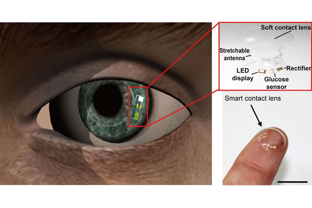 Bagan lensa kontak yang lembut dan cerdas untuk memantau kadar glukosa melalui air mata.  