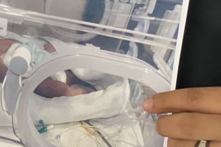 Seorang bayi berinisial HNM yang baru lahir pada 1 November 2023 tengah terbaring di Rumah Sakit Hermina Daan Mogot dalam kondisi kritis.