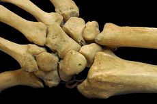 Mengapa Tulang Disebut sebagai Alat Gerak Pasif?