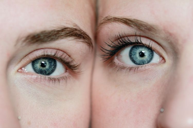 Bulu mata bisa rusak dan menjadi berwarna putih jika mata Anda mengalami gangguan radang kelopak mata.