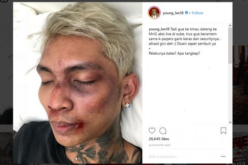 Unggah Foto Babak Belur, Young Lex Mengaku Berkelahi dengan K-popers