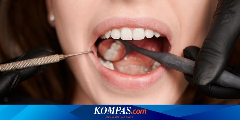 Karang Gigi Lepas Sendiri Baik Atau Justru Berbahaya
