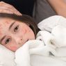 6 Komplikasi Campak yang Pantang Disepelekan
