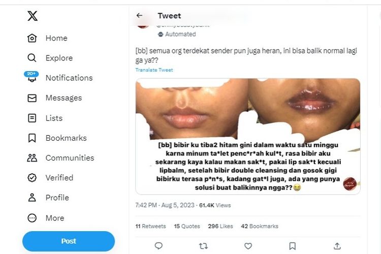 Tangkapan layar soal bibir yang menghitam karena penggunaan obat pemutih kulit.