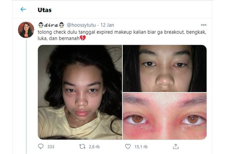 Tangkapan layar netizen yang wajahnya bengkak karena make up expired.