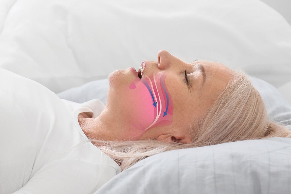 Memahami apa itu obstructive sleep apnea sangat penting karena bisa mengancam nyawa.