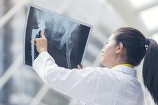 Deteksi Dini Jadi Cara Mencegah Kanker Tulang