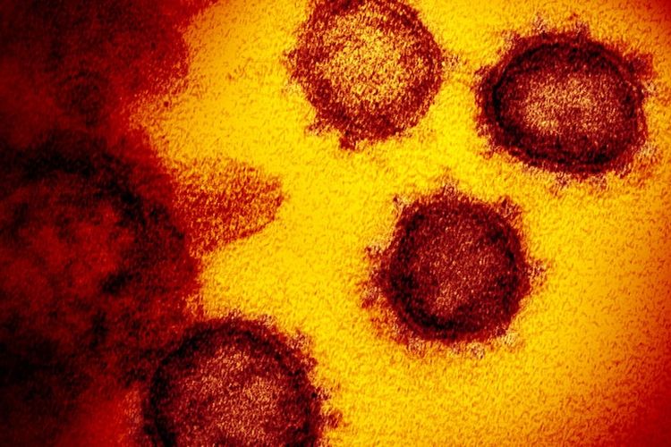 SARS-CoV-2 adalah virus corona terbaru yang menyebabkan pandemi namun bukanlah yang pertama kali terjadi.