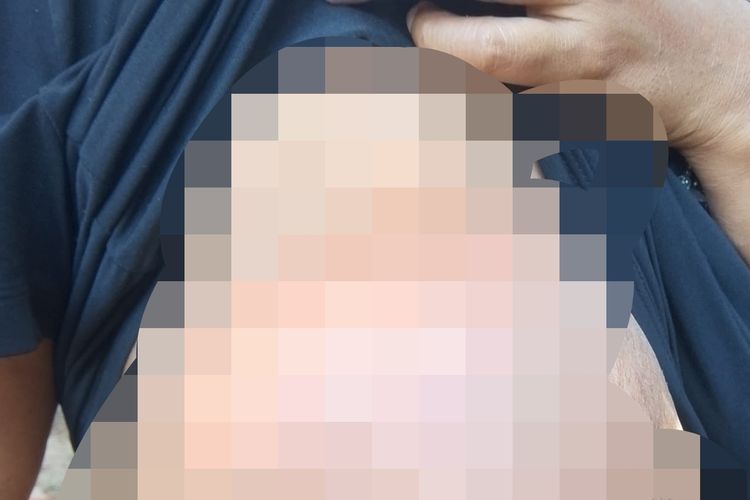 Dua Tahun Berobat ke Dukun, Penderita Kanker Payudara di Manggarai Timur Berharap Pengobatan Layak