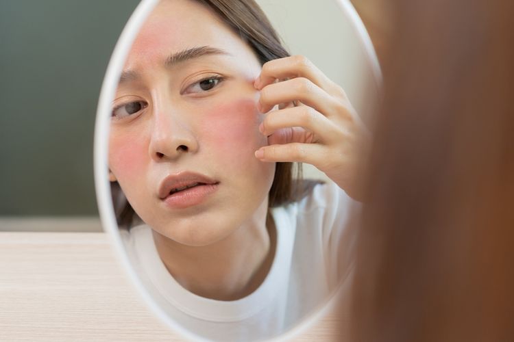 Kulit yang kemerahan adalah salah satu tanda tidak cocok pakai sunscreen