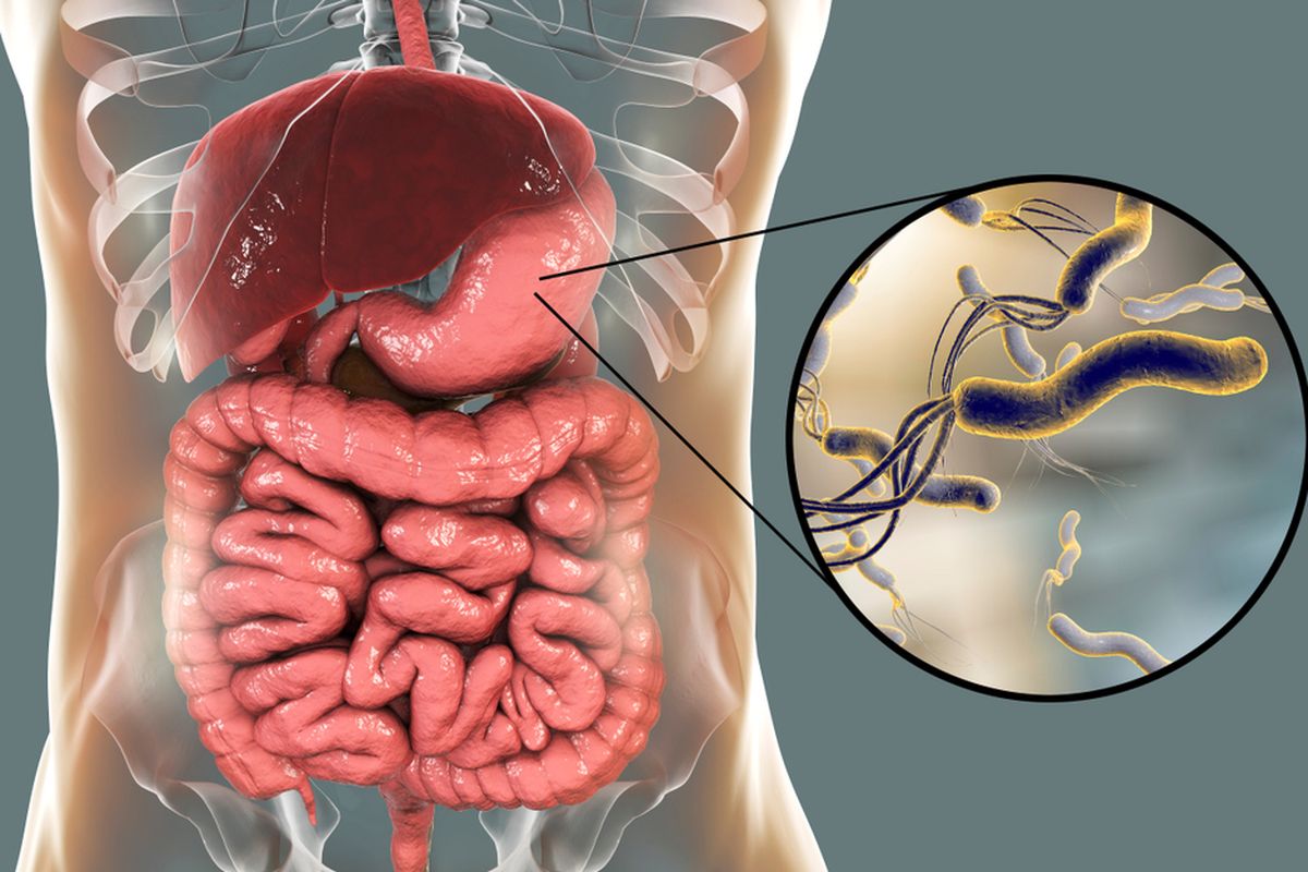 Ilustrasi Helicobacter Pylori