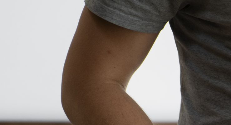 Mengapa Hernia Lebih Umum Terjadi pada Laki-laki?