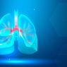 6 Ciri-ciri Paru-paru Tidak Sehat yang Harus Diwaspadai