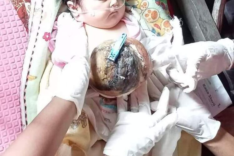 M Fareski, bayi berusia 27 hari yang mengidap penyakit Omphalocele butuh uluran tangan, beredar di media sosial, Sabtu (10/4/2021).